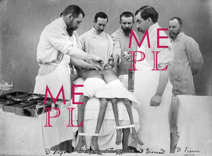 : Doyen Performs Conjoined Twins Operation, 1902 : Doyen Performs Conjoined Twins Operation, 1902