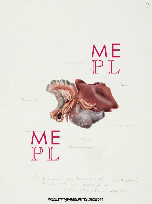  : Drawing of a seal intestine