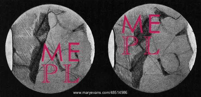 : Drawings of Mars showing its canals and polar : Drawings of Mars showing its canals and polar