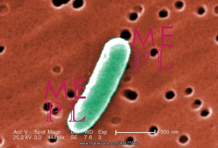 : E. coli, a common cause of bacterial diarrhea. ? : E. coli, a common cause of bacterial diarrhea. ?
