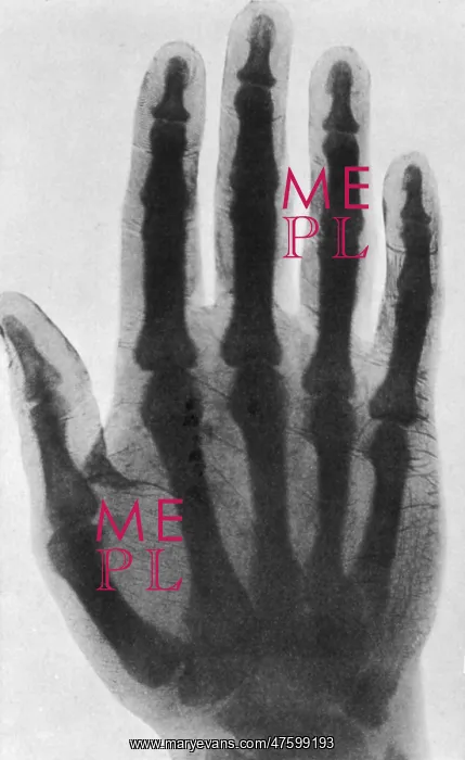 : Early X-ray, 1897 : Early X-ray, 1897