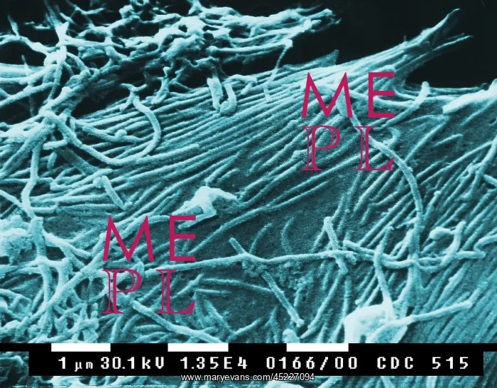 : Ebola virions (virus particles). Ebola hemorrhagic ? : Ebola virions (virus particles). Ebola hemorrhagic ?
