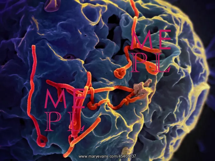 : Ebola virus particles (red) on a larger cell : Ebola virus particles (red) on a larger cell