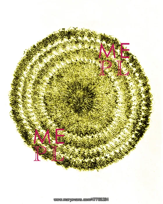 : Echinus Spine Section, Early Photomicrograph : Echinus Spine Section, Early Photomicrograph
