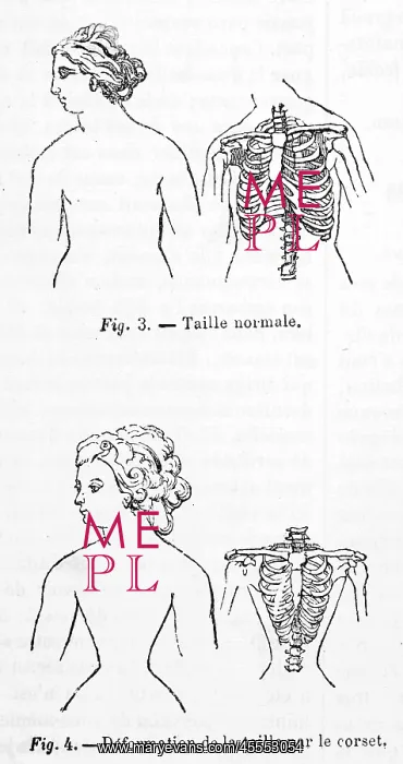 : Effect of wearing a Corset on the human body : Effect of wearing a Corset on the human body