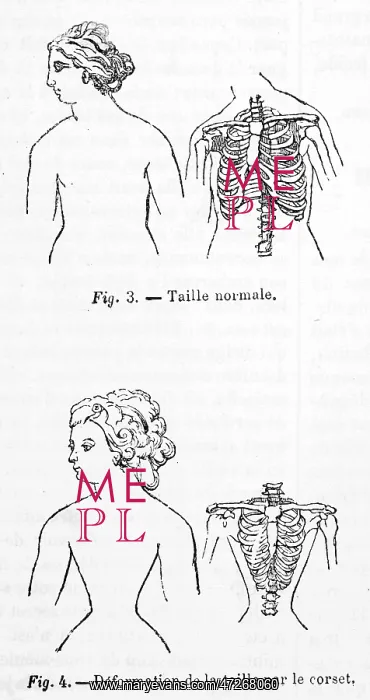 : Effect of wearing a Corset on the human body : Effect of wearing a Corset on the human body