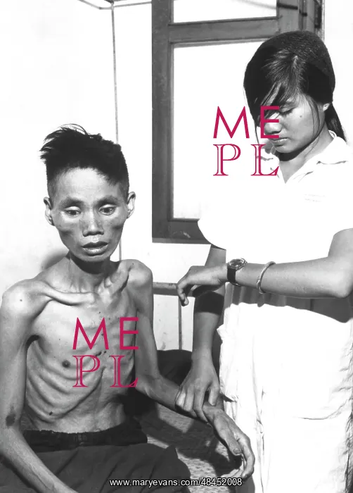 : The effects of starvation from being held : The effects of starvation from being held