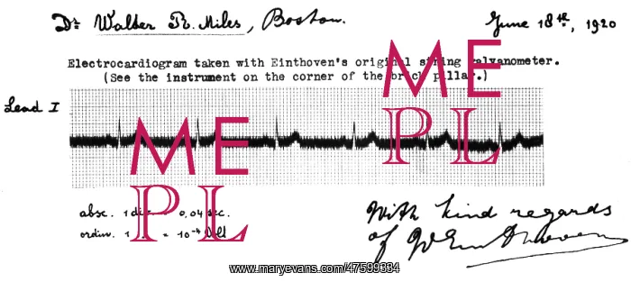 : Electrocardiogram, Einthoven's Original String Galvanometer : Electrocardiogram, Einthoven's Original String Galvanometer