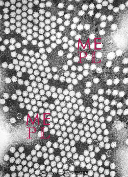 : Electron micrograph of the poliovirus. 1975.? : Electron micrograph of the poliovirus. 1975.?