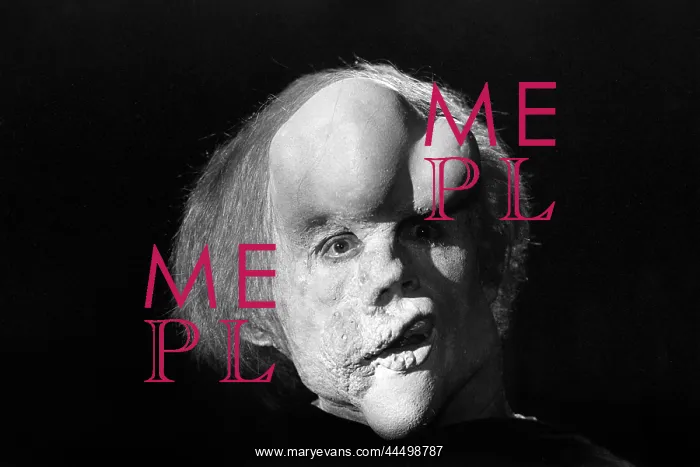 : The Elephant Man (1980) : The Elephant Man (1980)