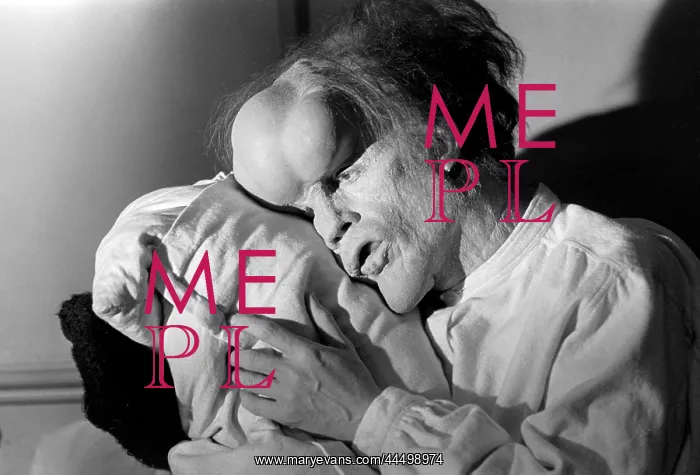 : The Elephant Man (1980) : The Elephant Man (1980)