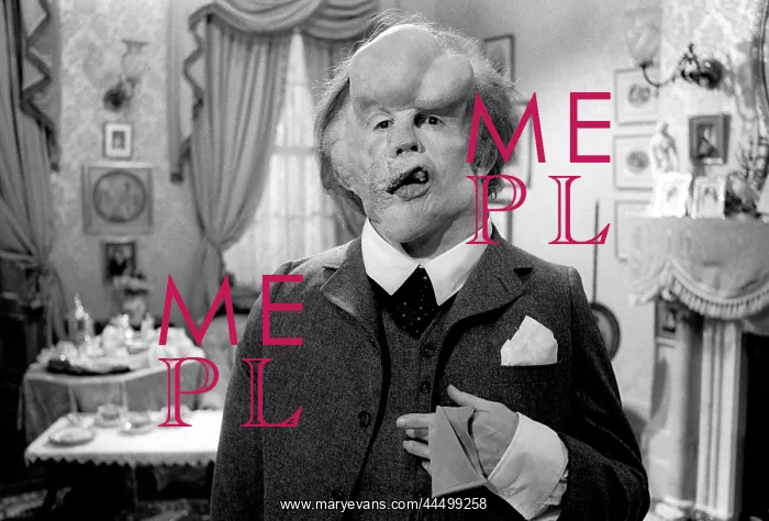 : The Elephant Man (1980) : The Elephant Man (1980)