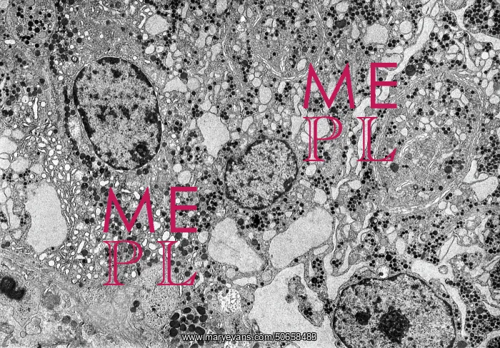  : Endoplasmic reticulum, TEM