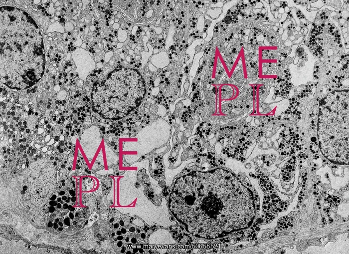 : Endoplasmic reticulum, TEM : Endoplasmic reticulum, TEM