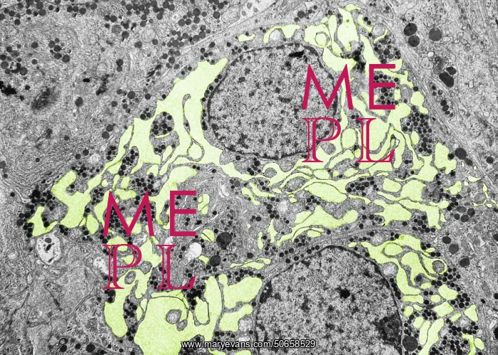 : Endoplasmic reticulum, TEM : Endoplasmic reticulum, TEM