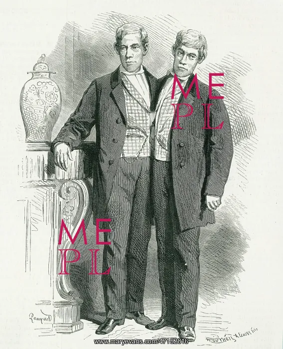: Eng and Chang, Siamese twins : Eng and Chang, Siamese twins