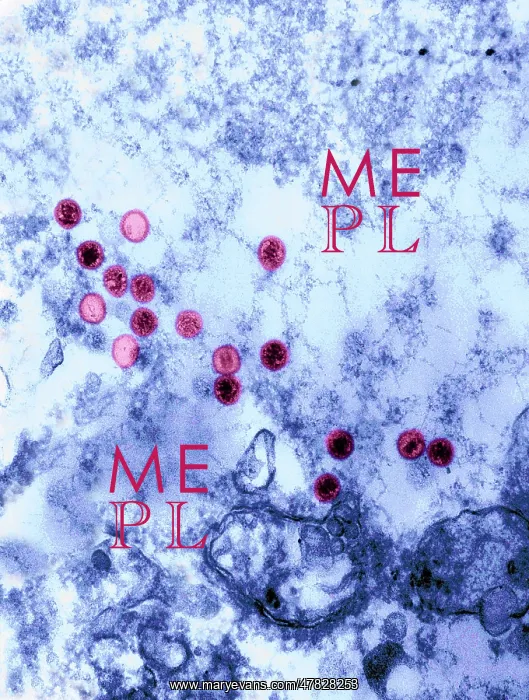 : Epstein-Barr Virus, TEM : Epstein-Barr Virus, TEM
