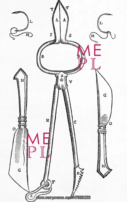 : Equipment for One of Tagliacozzi's Rhinoplasty Methods : Equipment for One of Tagliacozzi's Rhinoplasty Methods