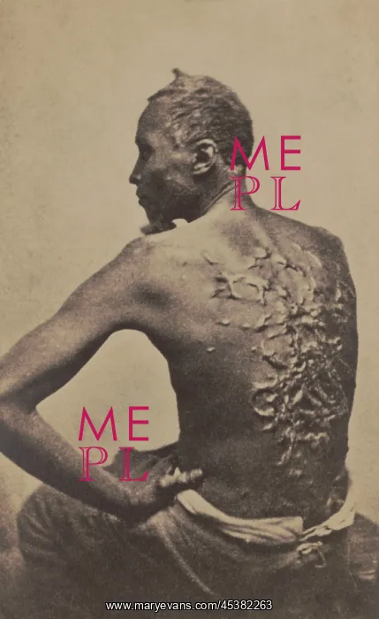 : Escaped slave Gordon, showing his scarred : Escaped slave Gordon, showing his scarred