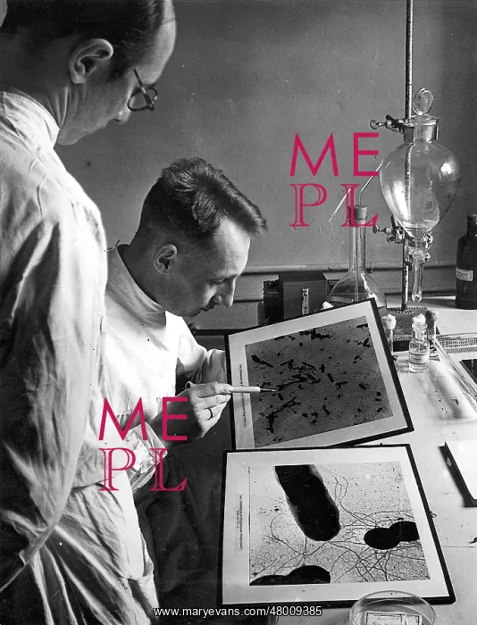 : Evaluation of the photomicrograph of the electronic microsco : Evaluation of the photomicrograph of the electronic microsco