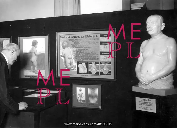 : Exhibition pieces of the Exhibit of Genetics and Eugenics : Exhibition pieces of the Exhibit of Genetics and Eugenics
