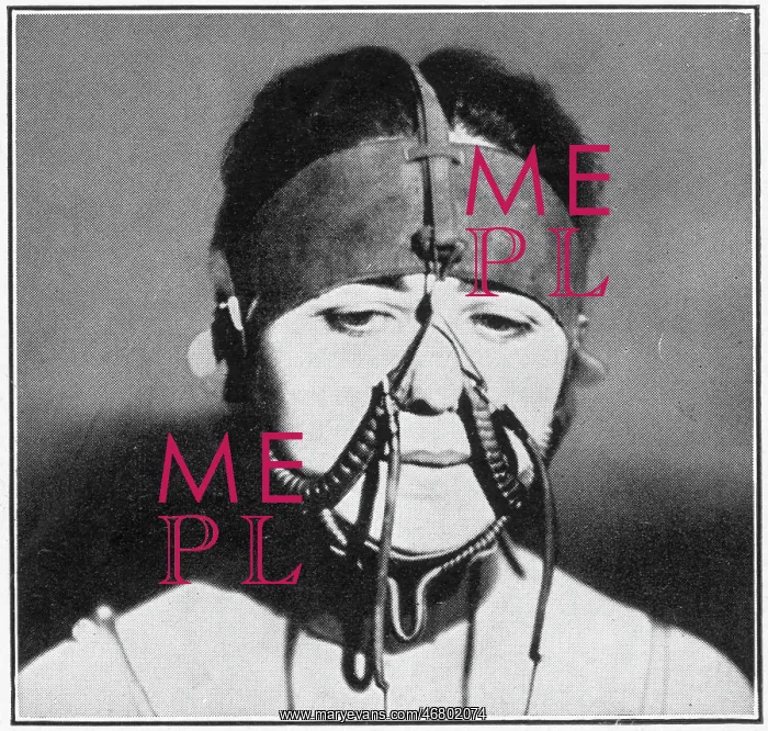 : Extreme process of beauty 1927 : Extreme process of beauty 1927