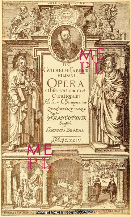 : Fabry, Wilhelm, 25.6.1560 - 15.2.1634, German : Fabry, Wilhelm, 25.6.1560 - 15.2.1634, German