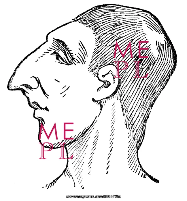 : Face and head of a cretin, 1902 : Face and head of a cretin, 1902