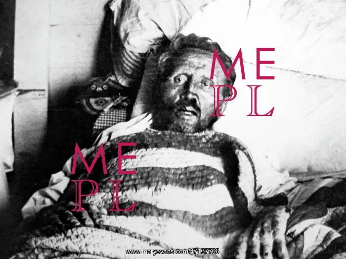  : Father Damien on his death bed in 1889