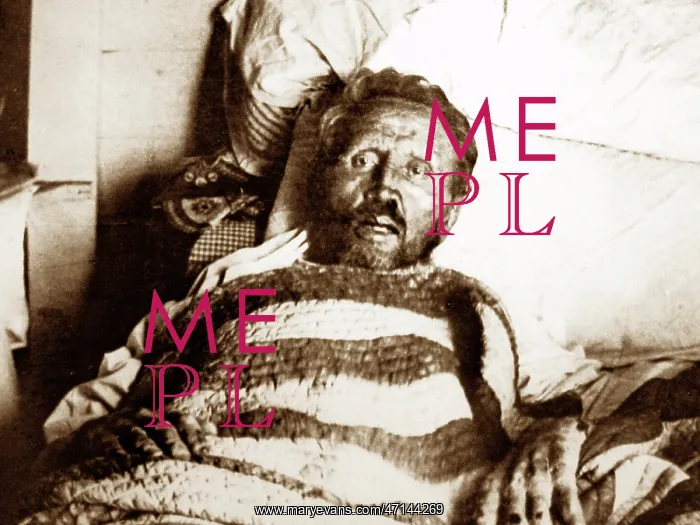  : Father Damien on his death bed in 1889
