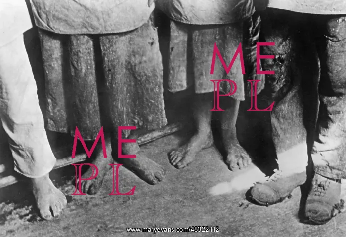 : Feet of begging adolescents, 1932 : Feet of begging adolescents, 1932