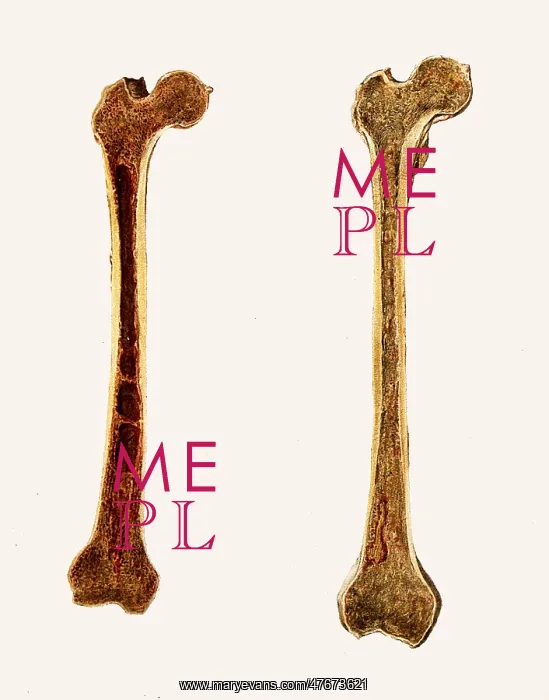 : Two Femur Bones Showing Marrow, 1897 : Two Femur Bones Showing Marrow, 1897
