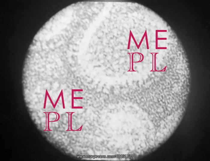 : Flu virus. USSR. March 1, 1974. The flu virus under an electro-microscope : Flu virus. USSR. March 1, 1974. The flu virus under an electro-microscope