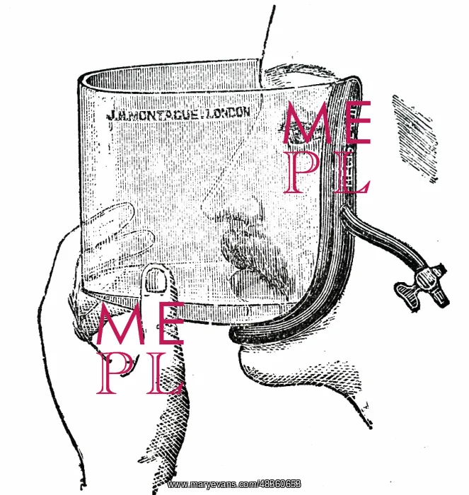 : Flux's open method of establishing anaethesia : Flux's open method of establishing anaethesia