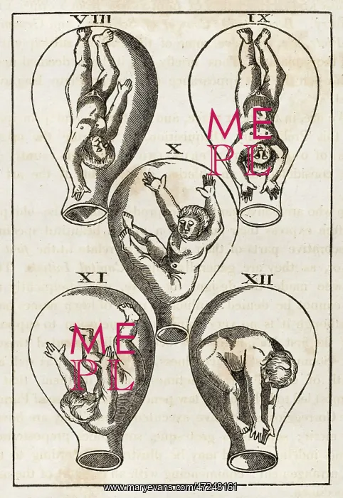 : FOETUS IN WOMB 1540 : FOETUS IN WOMB 1540
