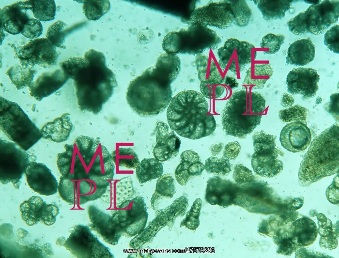 : Foraminiferan remains : Foraminiferan remains