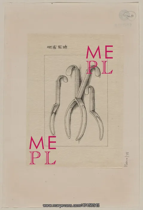 : Forceps?. Drawing shows each half of obstetrical : Forceps?. Drawing shows each half of obstetrical