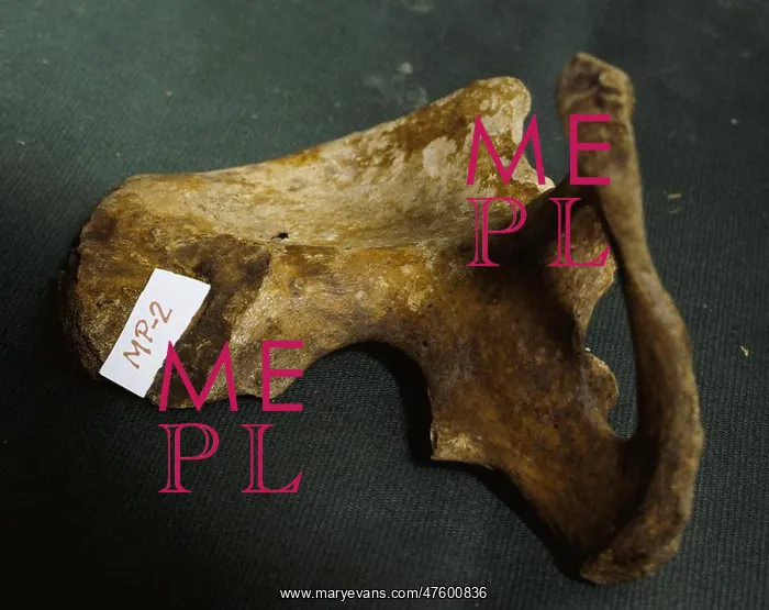 : Forensic Evidence, Pelvis Bone : Forensic Evidence, Pelvis Bone