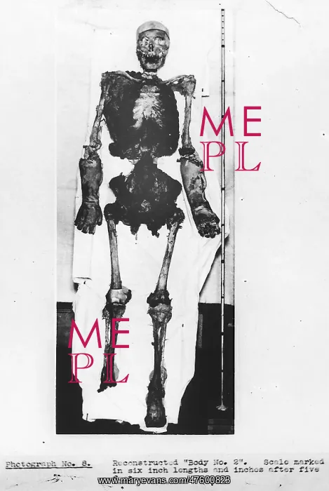: Forensic Evidence, Skeletal Reconstruction, Buck Ruxton Murd : Forensic Evidence, Skeletal Reconstruction, Buck Ruxton Murd