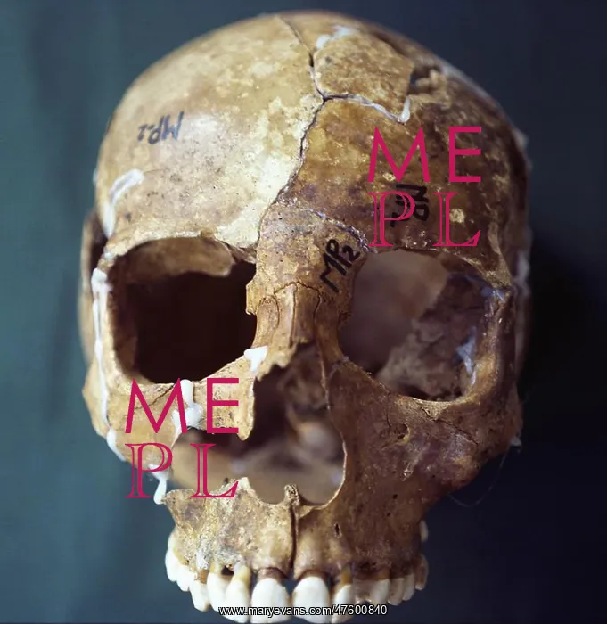 : Forensic Evidence, Skull Reconstruction : Forensic Evidence, Skull Reconstruction
