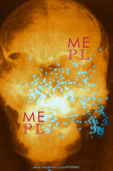 : Forensic X-Ray of Murder Victim : Forensic X-Ray of Murder Victim