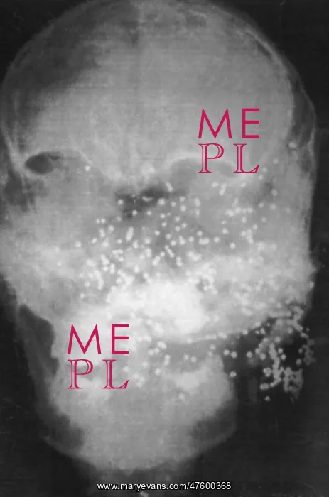 : Forensic X-Ray of Murder Victim : Forensic X-Ray of Murder Victim