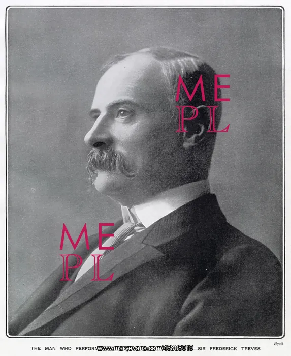: Frederick Treves : Frederick Treves