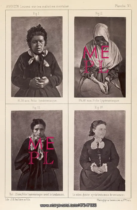  : FRENCH MENTAL PATIENTS 2
