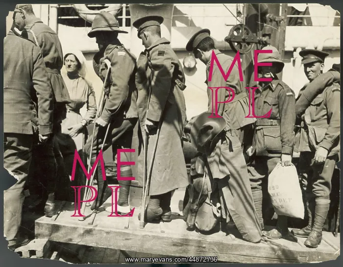 : GALLIPOLI WOUNDED 1915 : GALLIPOLI WOUNDED 1915