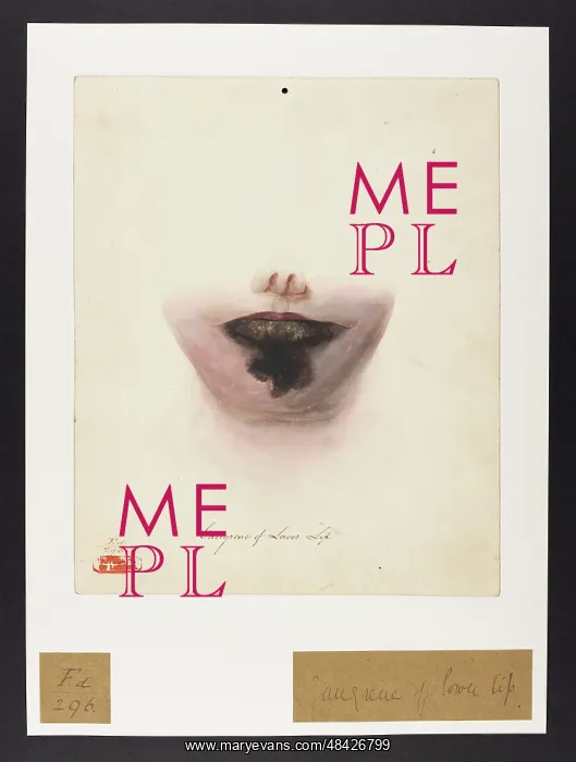  : Gangrene of the Lower Lip
