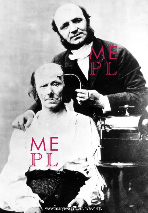 : G.B.A. Duchenne Performs Electrotherapy, 1861 : G.B.A. Duchenne Performs Electrotherapy, 1861