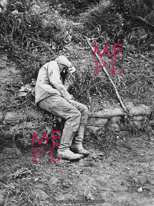 : German wounded WWI : German wounded WWI