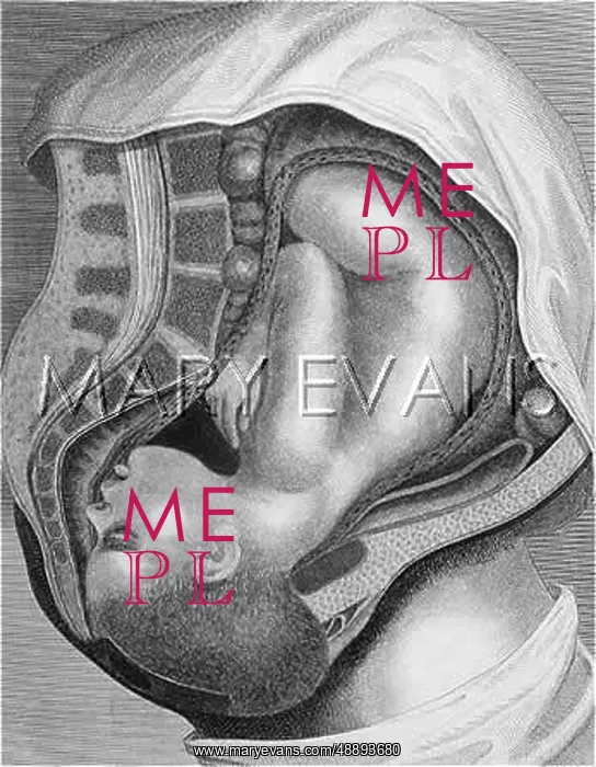  : GIVING BIRTH - 2ND STAGE