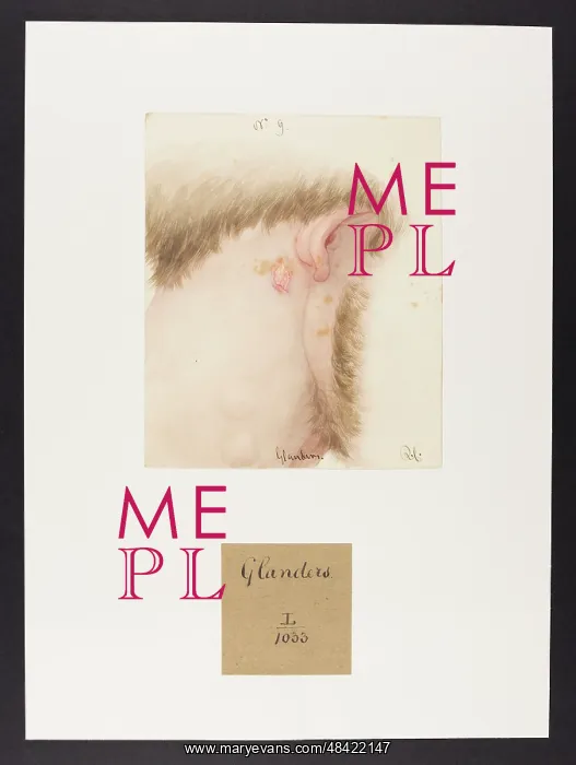 : Glanders. RC, (blank on verso) : Glanders. RC, (blank on verso)